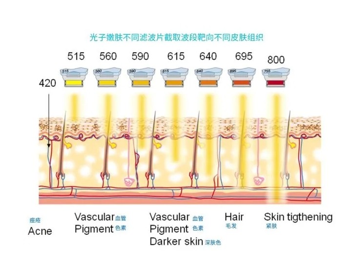 五大光子嫩膚技術(shù)（IPL、DPL、OPT、APT、BBL）及濾光片區(qū)別